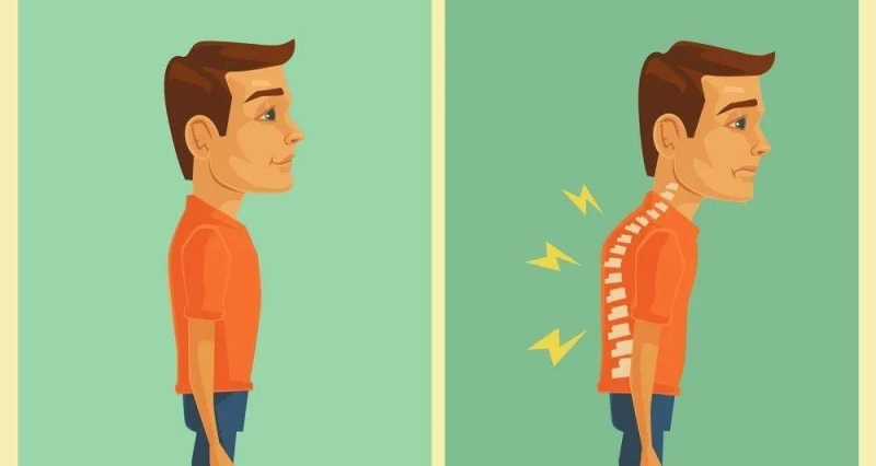 如何讓你更挺拔【駝背的矯正】