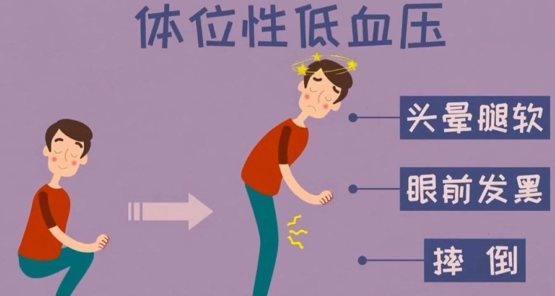 爲什麼蹲久了站起來會眩暈、眼前發黑？是正常現象嗎？