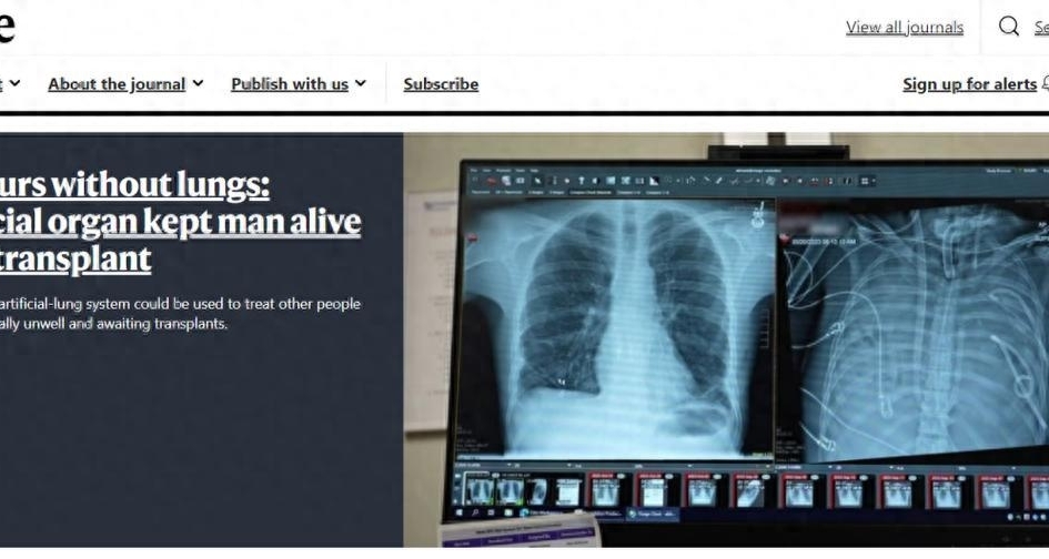 快讯：人类首次实现无肺生存48小时，为肺移植开辟新窗口