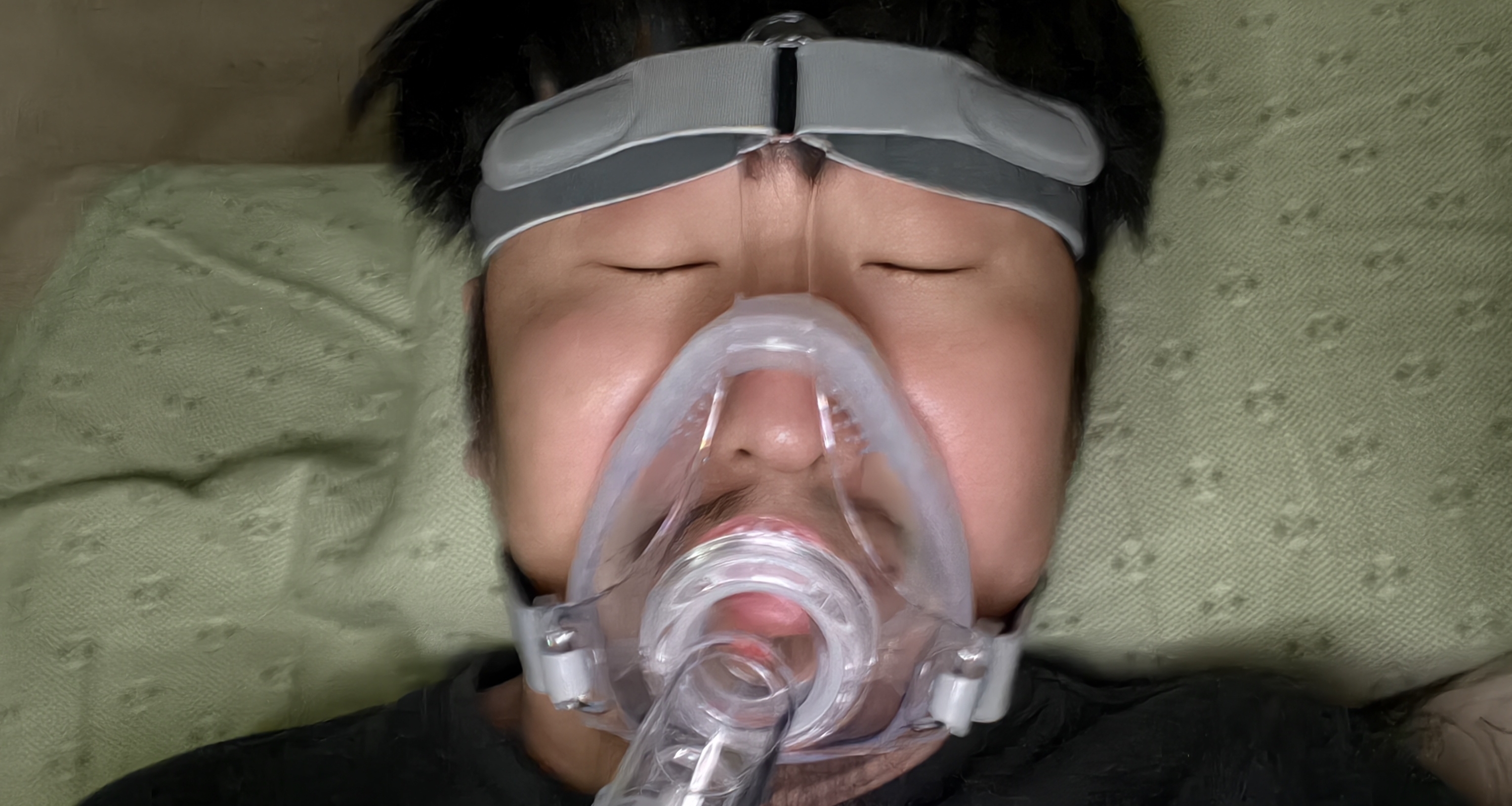 我宣布。跑刀成功换来大红复苏呼吸机