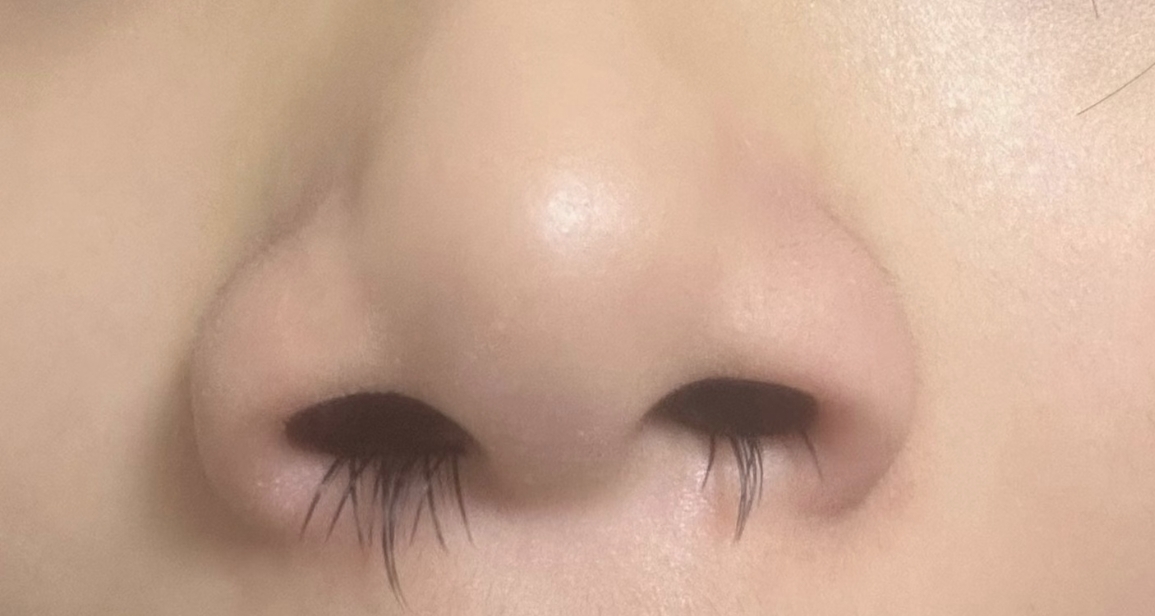喫燙的就流鼻涕，到底是什麼原因？