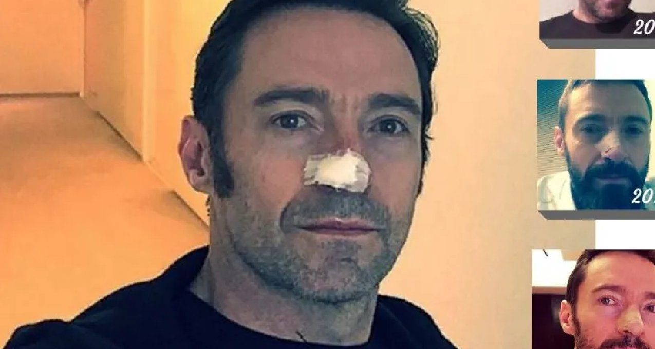 夏季科普 | 堂堂金剛狼也會被它困擾多年？！