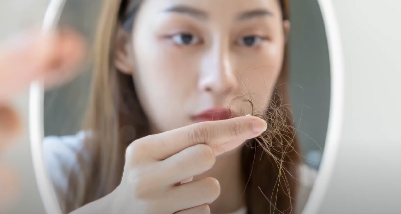 “变秃”趋向年轻化,人间