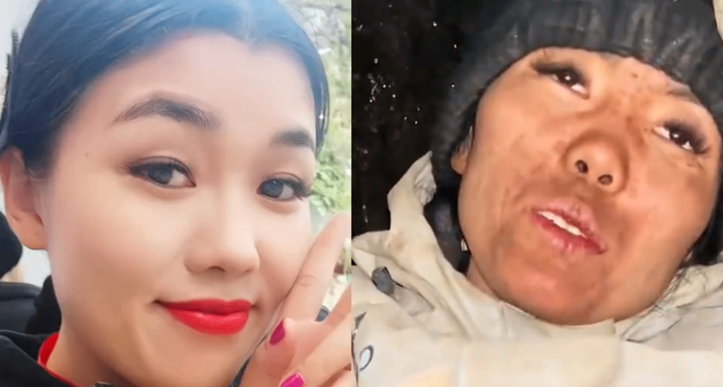 冷美人暈倒醒來後說不甘心，37 天漲粉近 20 萬，暴瘦至 84.5 斤