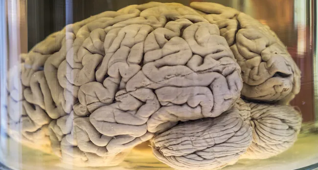 为什么我们的大脑会有那些奇怪的褶皱？每个人的大脑褶皱一样吗？