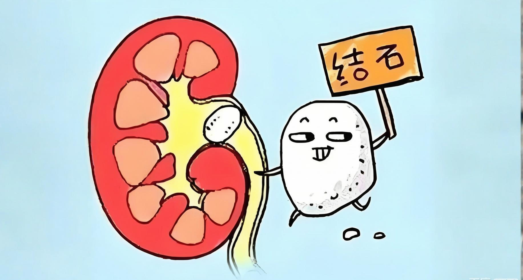 這些不良飲食習慣，正在“養”結石！