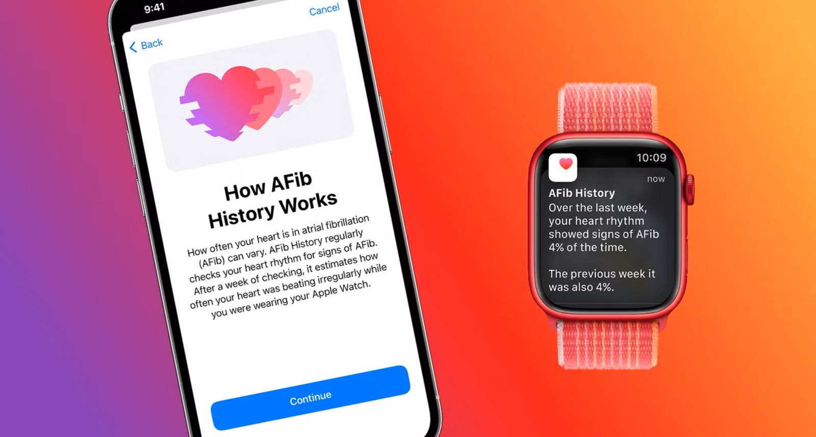 Apple Watch“房颤历史”功能在华获二类医疗器械资质。