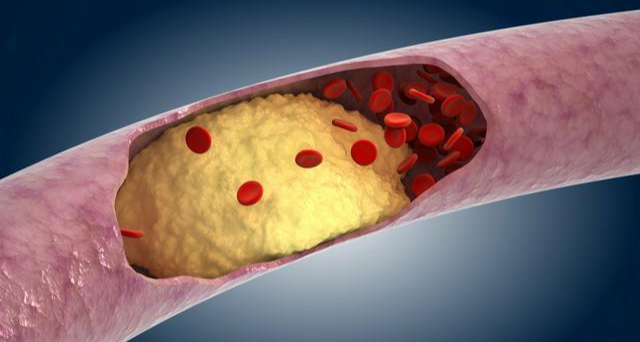 如何在日常生活中判斷血液是否粘稠？