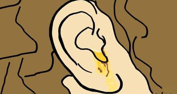 耳朵裏“流油”，是身體出問題了嗎？