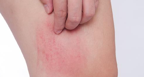 【冷百科】人類爲啥會有癢的感覺呢？