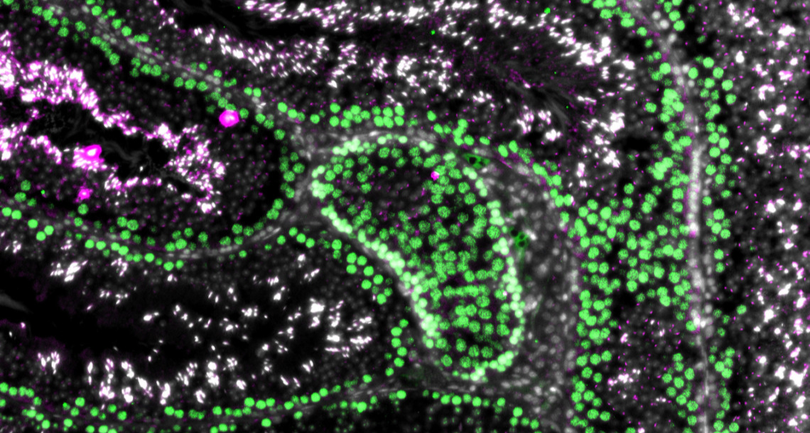 男性避孕重大突破：靶向减数分裂实现安全可逆的非激素方案