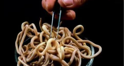 ⚡人人肚子里几乎都有蛔虫，为何现在却很少见到了❓⚡