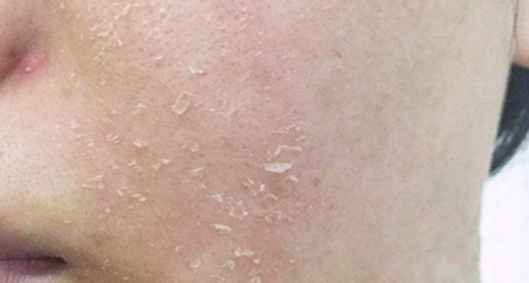 洗完脸紧绷 = 皮肤在掉血！别再拿“涩涩的”当干净了