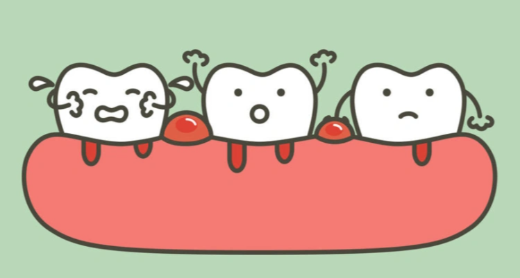 牙龈反复出血？你找到根源了吗？