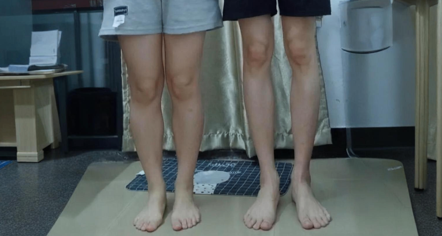 为什么男生的腿看起来总是比女生更细？