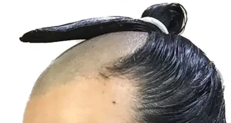 被嫌弃到全民标配，流行七百年的“日式秃头”经历了啥？