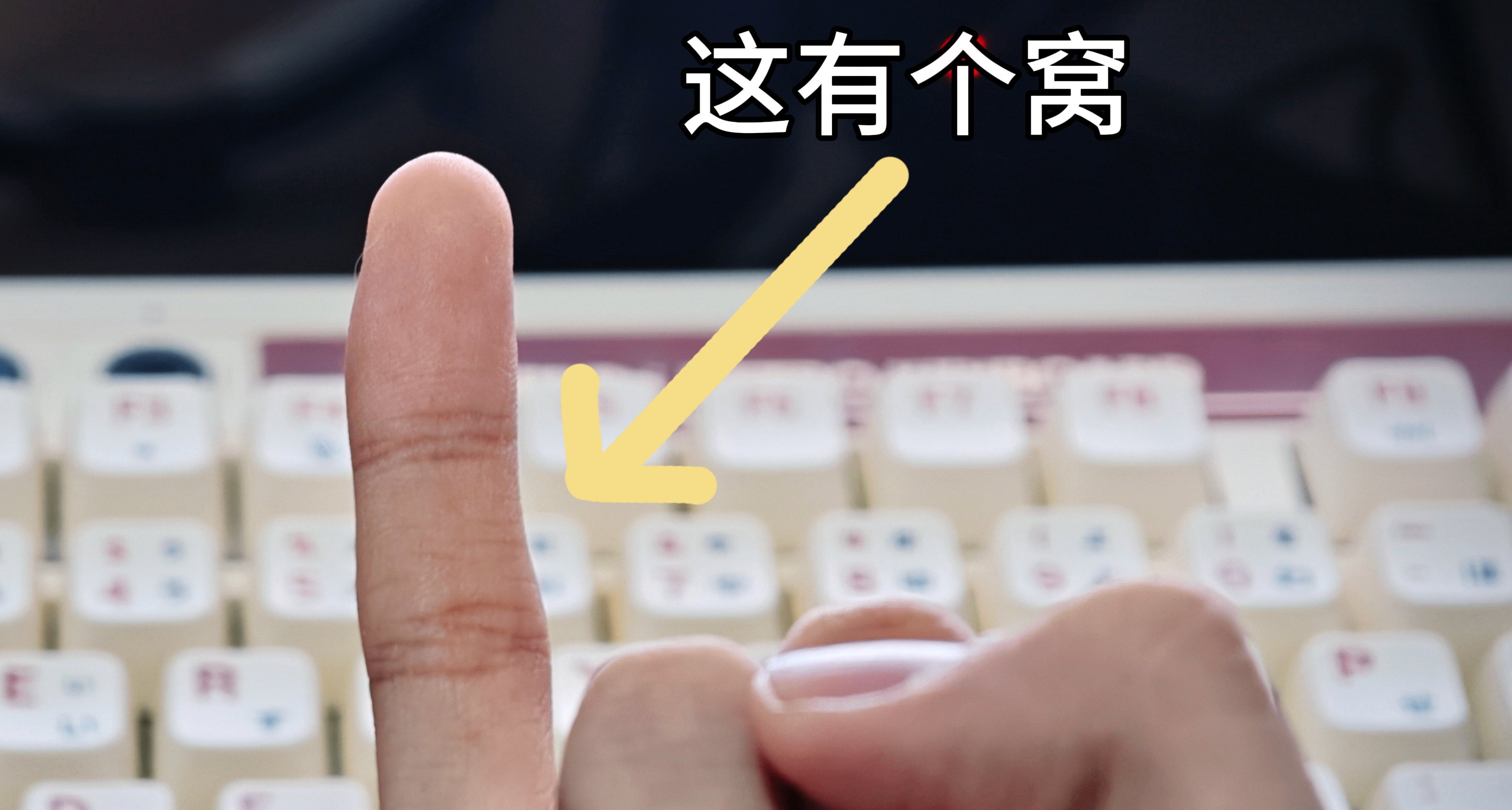 我小拇指打游戏打弯了，趁年轻自查一下还来得及！